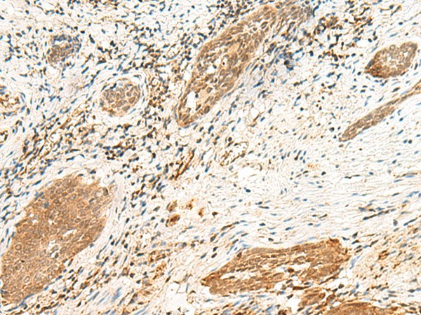 POLR1D Polyclonal Antibody (E-AB-52799)