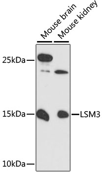 LSM3 Polyclonal Antibody (E-AB-90604)