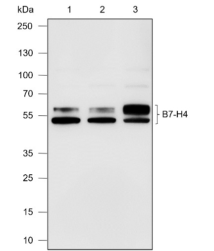 Recombinant B7-H4 Monoclonal Antibody (AN301876L)