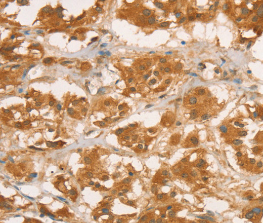 CPB1 Polyclonal Antibody (E-AB-14889)