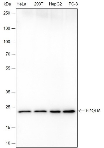Recombinant HIP2/LIG Monoclonal Antibody (AN301704L)