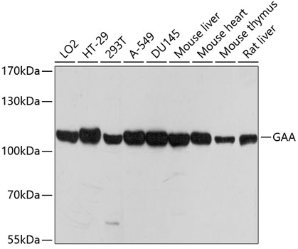 GAA Polyclonal Antibody (E-AB-65554)