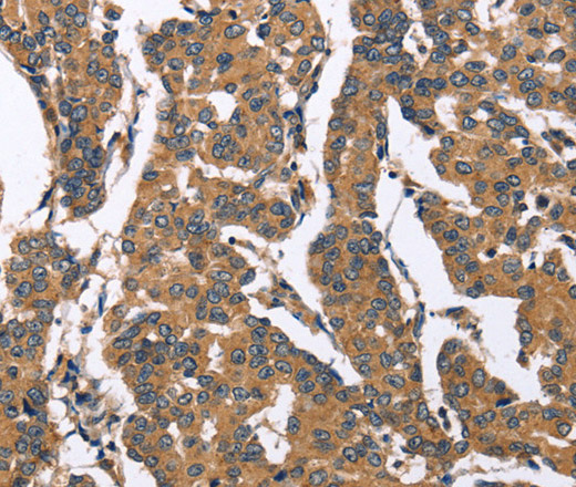 BNIP2 Polyclonal Antibody (E-AB-16257)