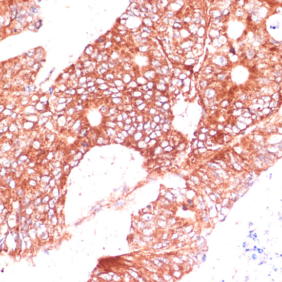 FAM98A Polyclonal Antibody (E-AB-66587)