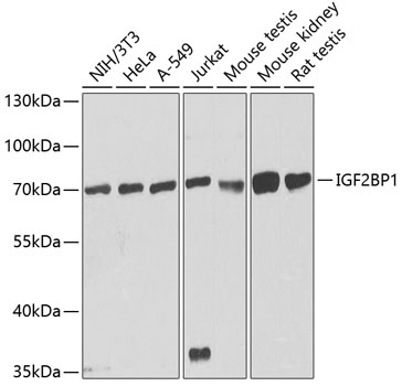 IGF2BP1 Polyclonal Antibody (E-AB-60322)