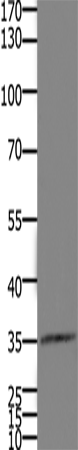 HOXD11 Polyclonal Antibody (E-AB-12510)