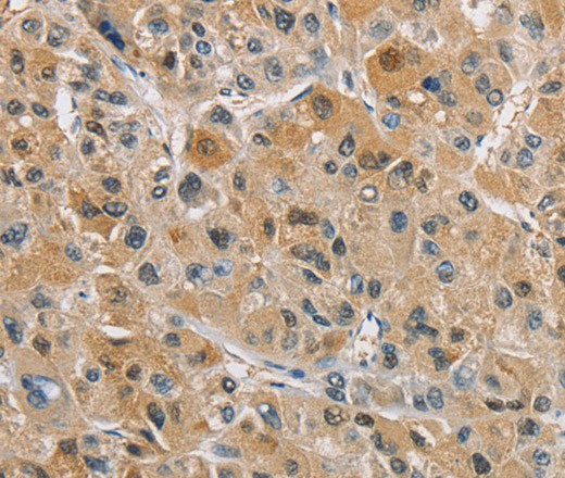 NAPSA Polyclonal Antibody (E-AB-10821)