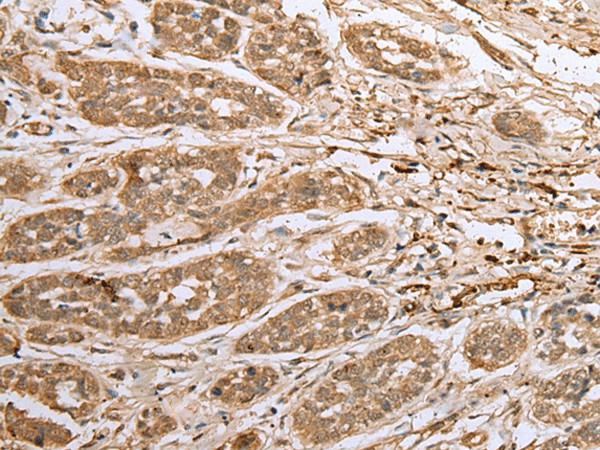 ATXN7L3 Polyclonal Antibody (E-AB-18358)