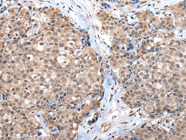 CTBP1 Polyclonal Antibody (E-AB-17718)