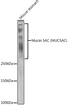 Mucin 5AC Polyclonal Antibody (E-AB-93206)