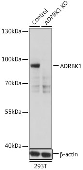 (KO Validated) ADRBK1 Polyclonal Antibody (E-AB-60399)