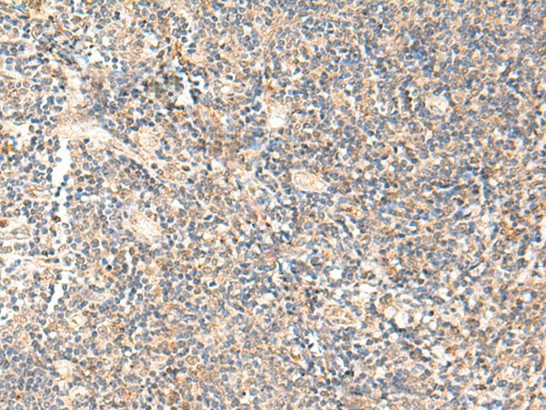PPP1R3C Polyclonal Antibody (E-AB-52884)