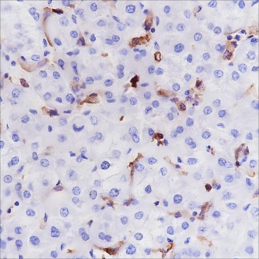 Recombinant HLA-DRA Monoclonal Antibody (AN301552L)