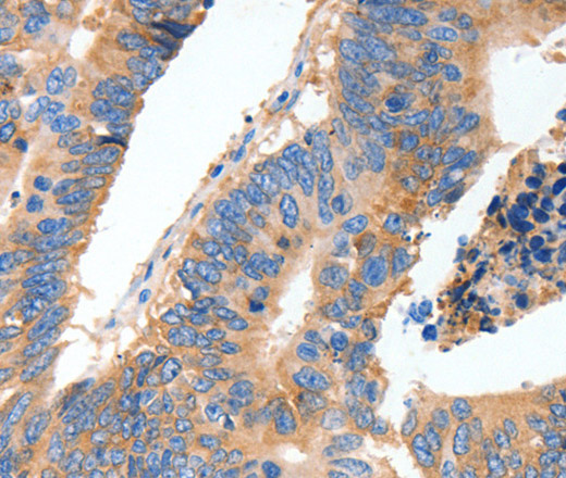 MUC6 Polyclonal Antibody (E-AB-12786)
