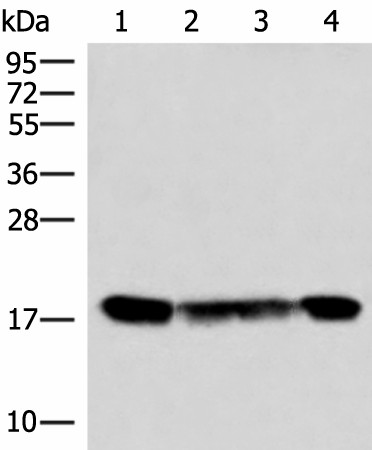 PEMT Polyclonal Antibody (E-AB-18144)