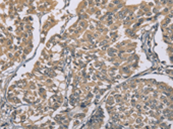 ZBTB2 Polyclonal Antibody (E-AB-53223)
