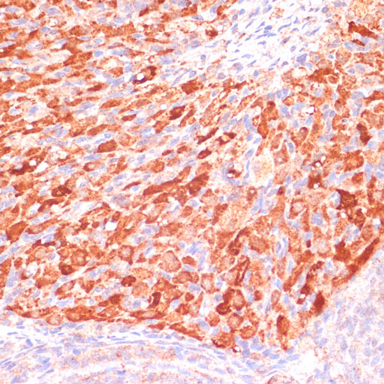 ASNS Polyclonal Antibody (E-AB-66660)