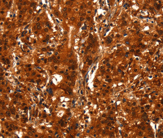 BCAS3 Polyclonal Antibody (E-AB-15963)