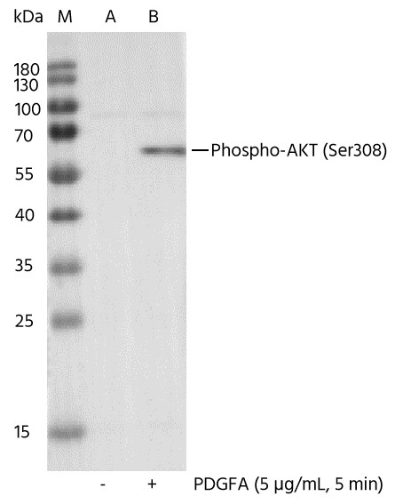 Recombinant Phospho-Akt (Thr308) Monoclonal Antibody (AN300085L)