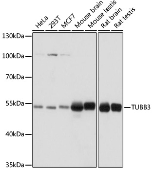 (KO Validated) TUBB3 Polyclonal Antibody (E-AB-67038)