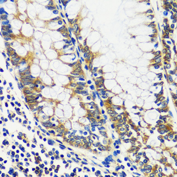 CCDC124 Polyclonal Antibody (E-AB-66266)