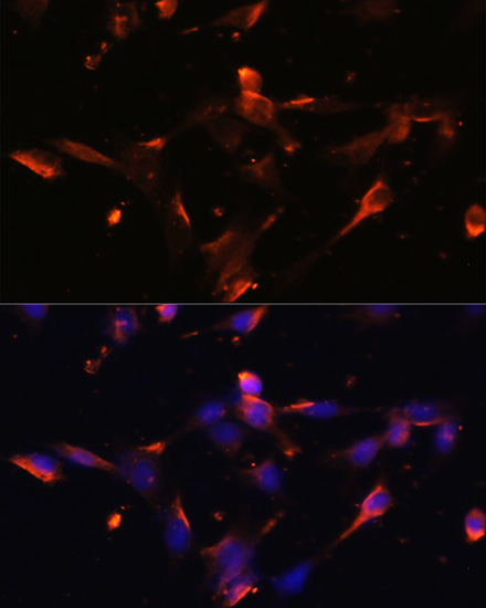 CLDN5 Polyclonal Antibody (E-AB-65744)