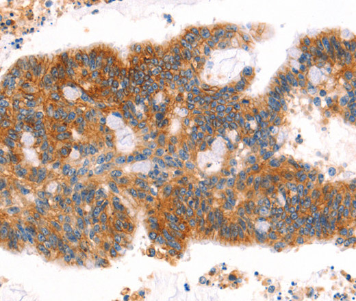 AFDN Polyclonal Antibody (E-AB-15958)
