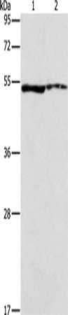 ALDH3A1 Polyclonal Antibody (E-AB-14534)