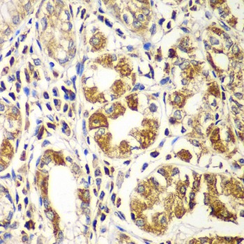 RAC1 Polyclonal Antibody (E-AB-62187)