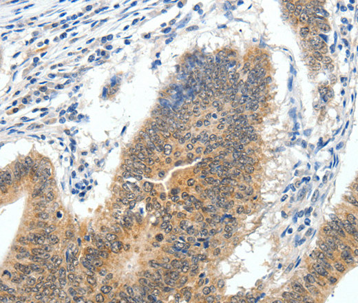 ECE2 Polyclonal Antibody (E-AB-14051)