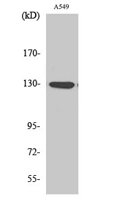 Phospho-JAK1 (Tyr1022) Polyclonal Antibody (E-AB-20913)