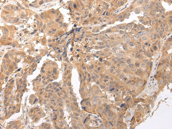 CLDND2 Polyclonal Antibody (E-AB-17706)