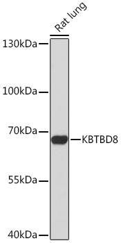 KBTBD8 Polyclonal Antibody (E-AB-92076)
