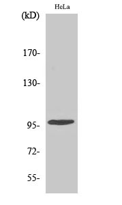 Phospho-CHEK2 (Thr68) Polyclonal Antibody (E-AB-20843)