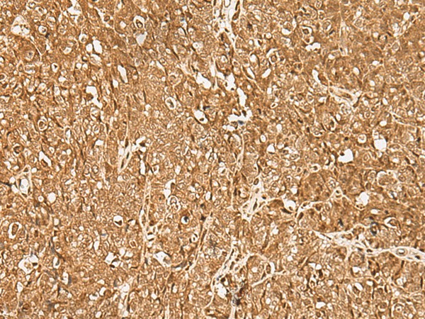 GMEB2 Polyclonal Antibody (E-AB-18008)