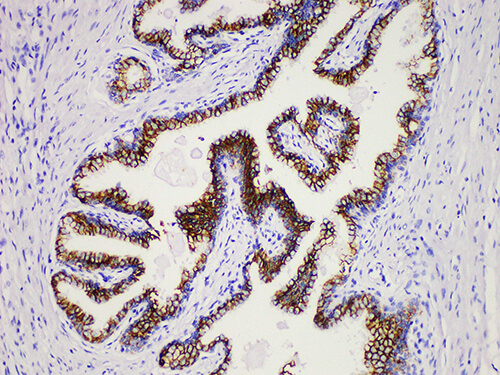 PSAP Monoclonal Antibody (ELAB6680-M)
