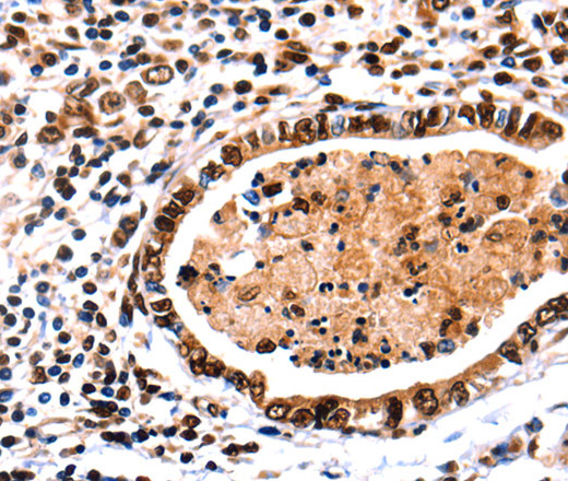 DNMT3A Polyclonal Antibody (E-AB-10288)