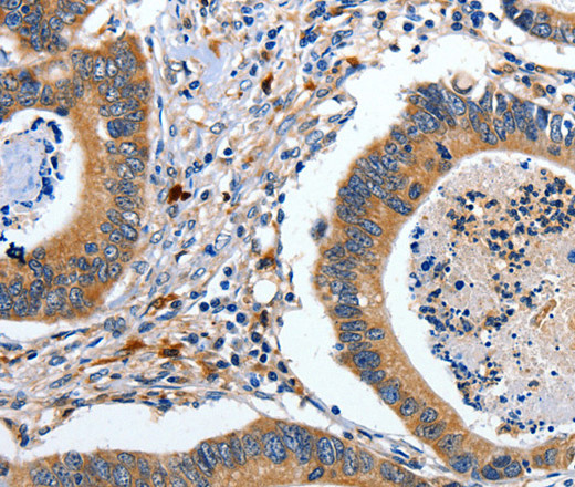EFNB2 Polyclonal Antibody (E-AB-14063)