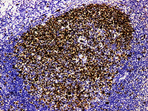 TOPO2A Monoclonal Antibody (ELAB6515-M)