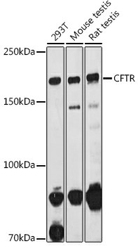 CFTR Polyclonal Antibody (E-AB-93400)