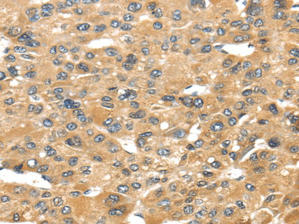 UCP1 Polyclonal Antibody (E-AB-17510)