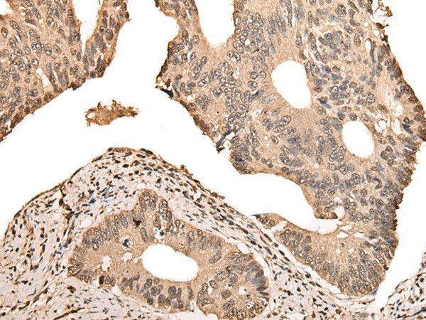 ZSCAN12 Polyclonal Antibody (E-AB-18473)
