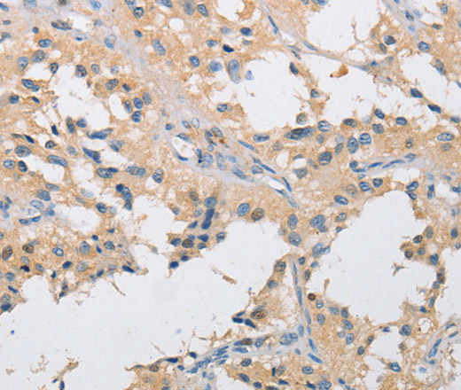 IKK gamma Polyclonal Antibody (E-AB-14622)