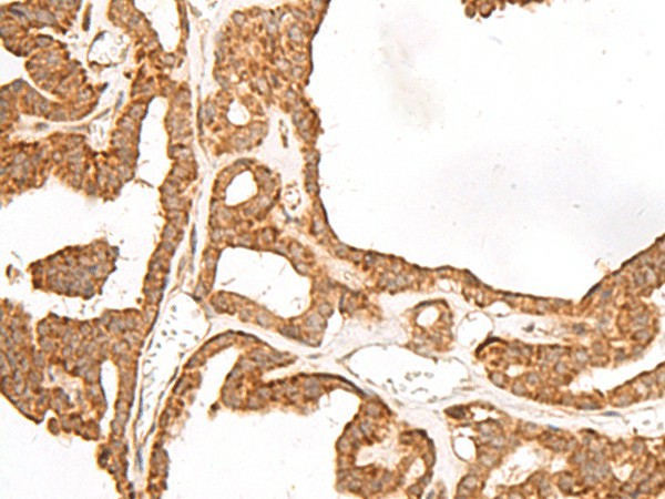 GBGT1 Polyclonal Antibody (E-AB-19900)