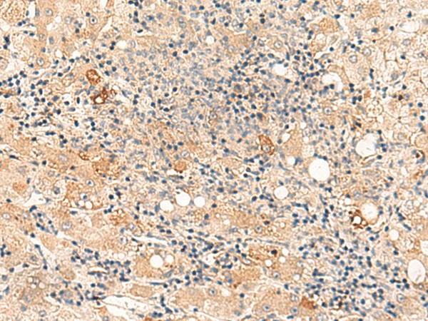 SULT4A1 Polyclonal Antibody (E-AB-52867)