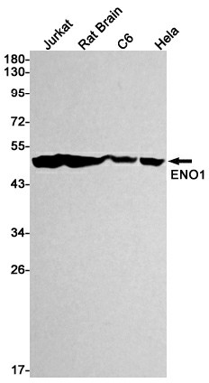 Recombinant ENO1 Monoclonal Antibody (E-AB-81454)