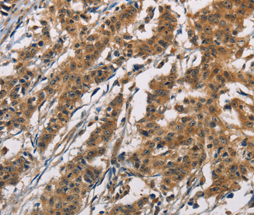 ATP2C1 Polyclonal Antibody (E-AB-14777)