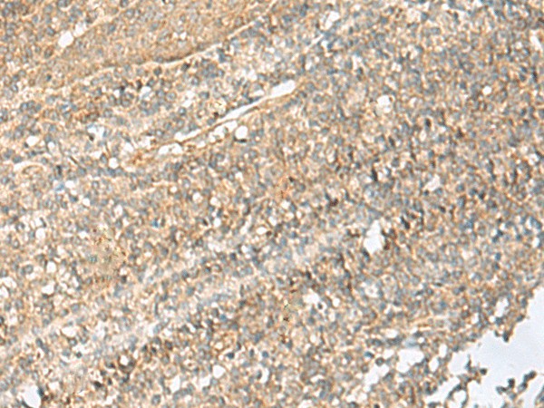 NID2 Polyclonal Antibody (E-AB-18873)