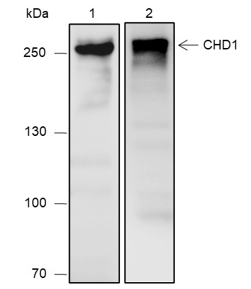 Recombinant CHD1 Monoclonal Antibody (AN301930L)
