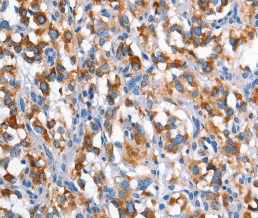 CD226 Polyclonal Antibody (E-AB-15975)